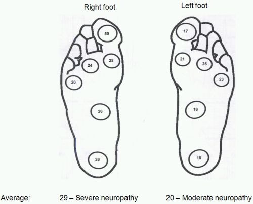 Diabetic foot screening