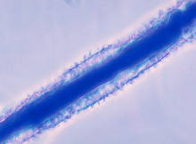 Conidiophore of Aspergillus flavus