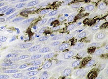 Dendritic cells in the epidermis