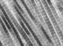 Collagen fibers - Electron microscopy