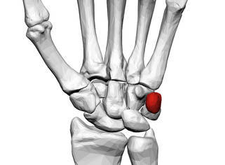 Pisiform is a sesamoid bone in the tendon of - Anatomy MCQ