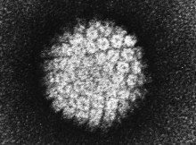 Human Papillomavirus Electron Microscopy