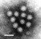 Transmission electron micrograph of Norwalk virus.