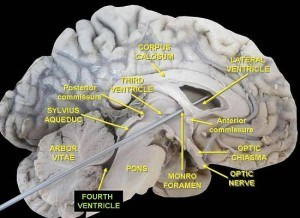 Roof the fourth ventricle - Anatomy MCQ « PG Blazer