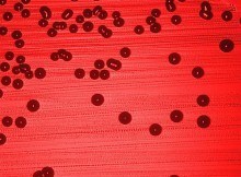 Haemophilus colonies on blood agar
