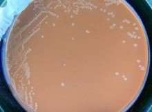Haemophilus influenzae colonies in chocolate agar