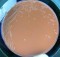 Haemophilus influenzae colonies in chocolate agar