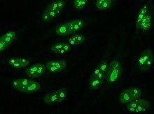 nucleolar immunofluorescence pattern