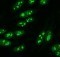 nucleolar immunofluorescence pattern
